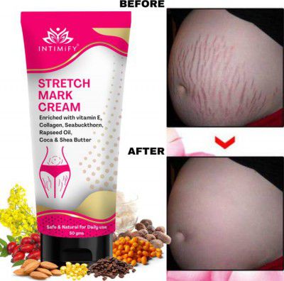 INTIMIFY Pregnancy stretch mark removal cream, Remove Pregnancy Scars For Women 50gm (50 g)